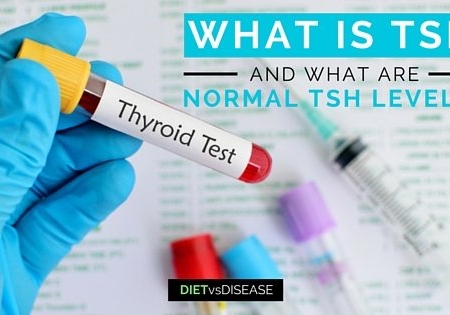 TSH - Tầm soát chức năng tuyến giáp
